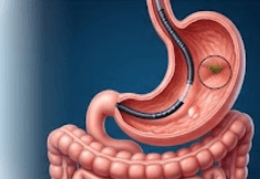 Gastroenterology